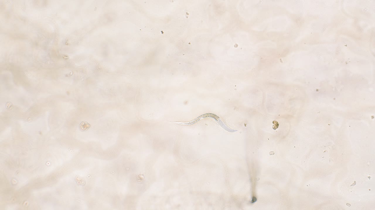 Single nemotode moving in Petri dish agar substrate