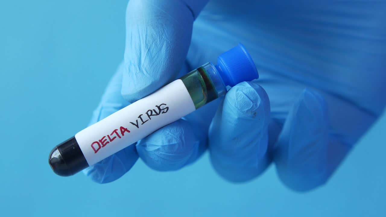Campione di virus Delta in provetta