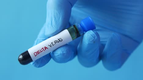 delta virus test tube sample