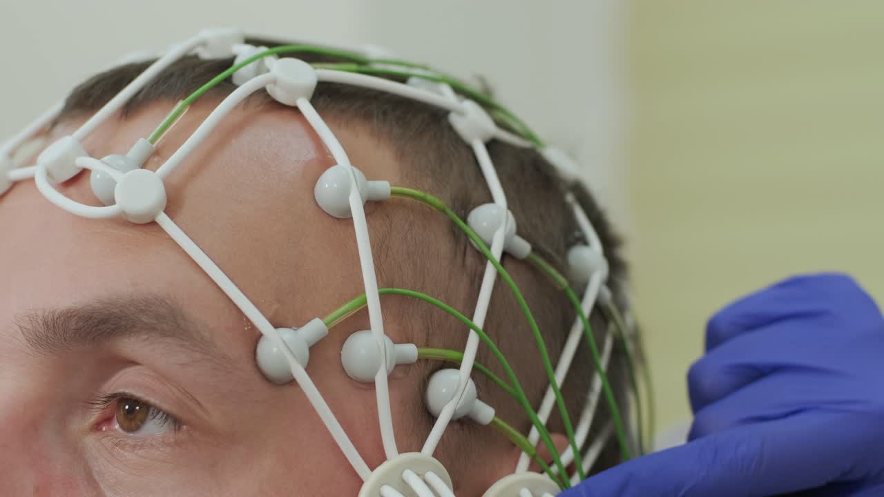 тестирование мозга пациента с помощью энцефалографии в медицинском центре