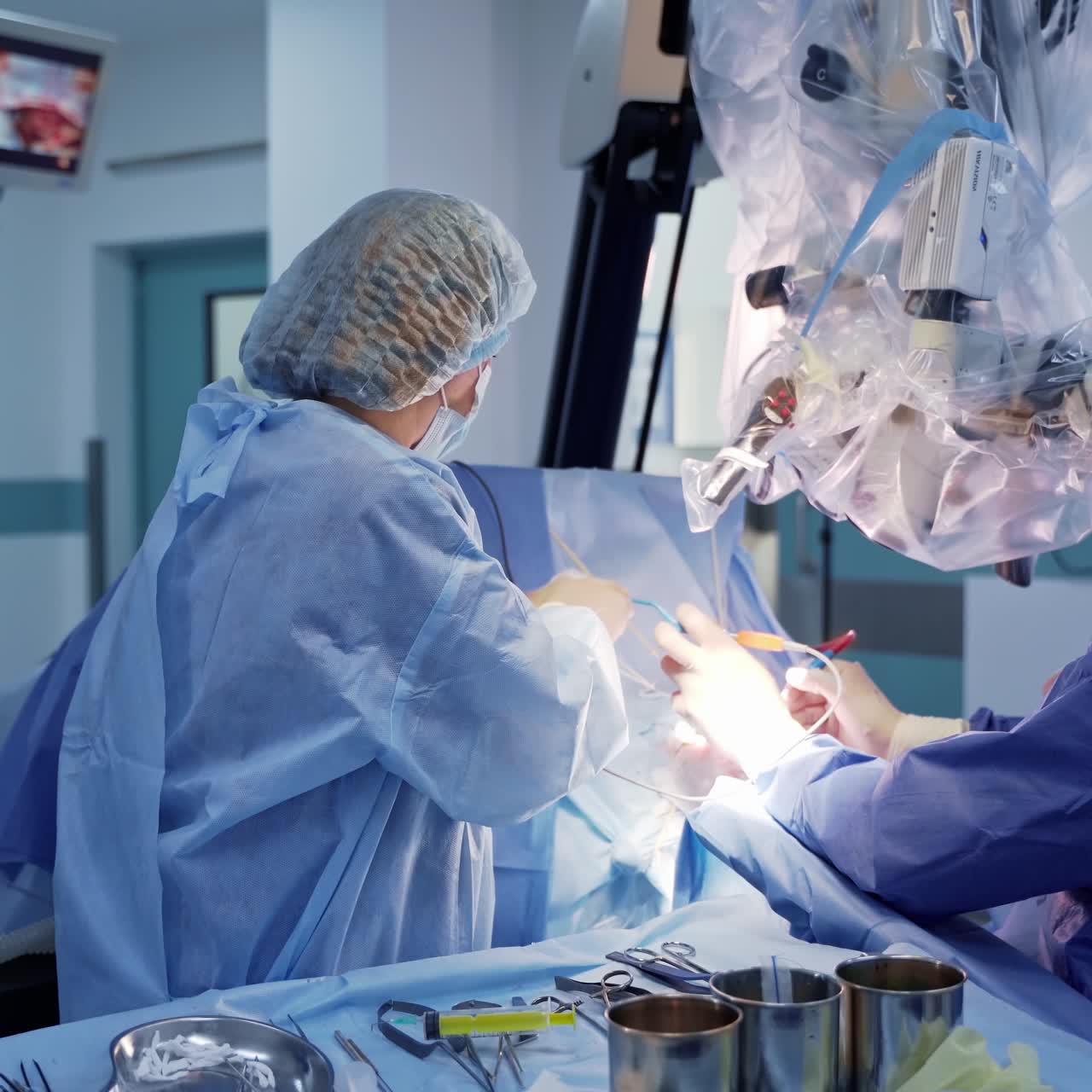 Neurosurgical procedure. Group of medical specialists perform a neurosurgery looking through the microscope. Nurse assists the doctors in surgical room.