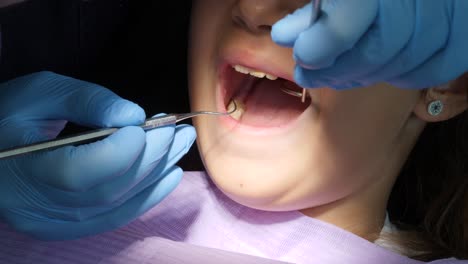 primer plano de la boca abierta de una niña en el dentista durante un chequeo dental