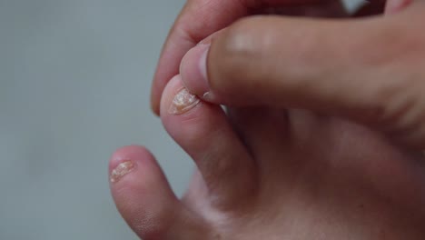 Desgaste-De-Las-Uñas-De-Los-Pies,-Traumatismo-De-Las-Uñas-Tallado-Con-La-Mano,-Primer-Plano-De-4k