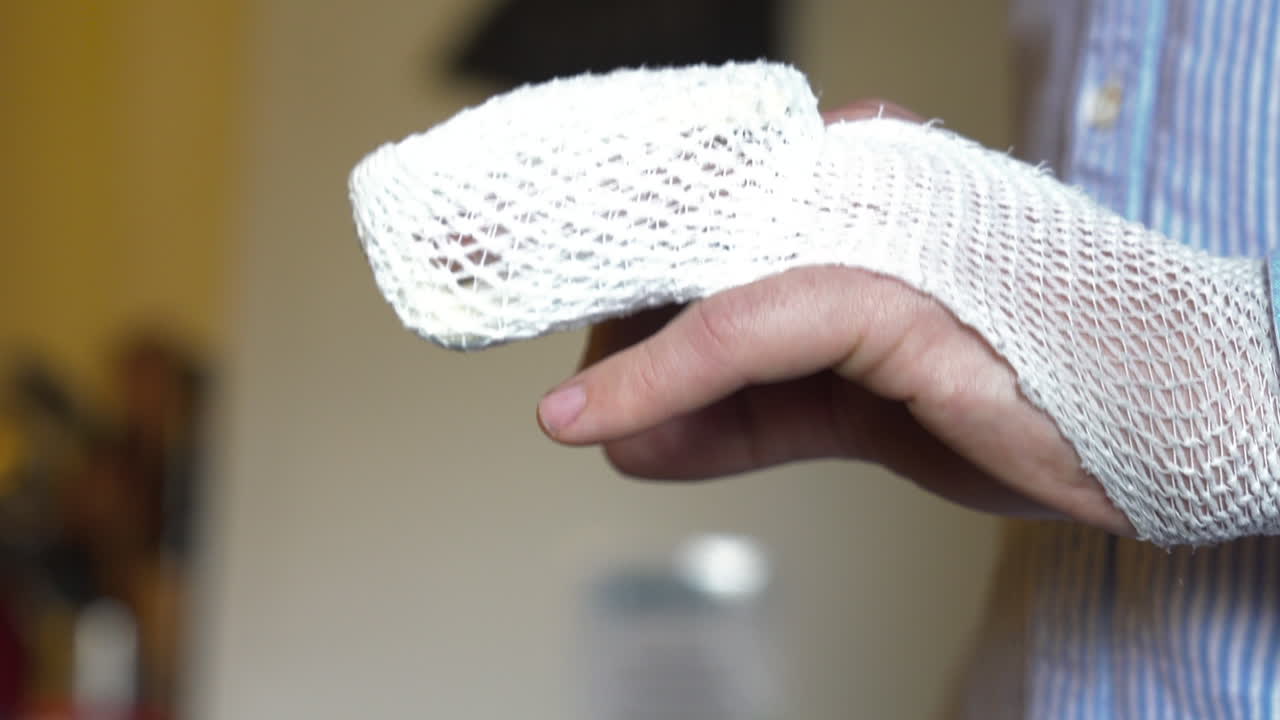 primer plano lateral de un dedo roto, mano fracturada, con vendaje