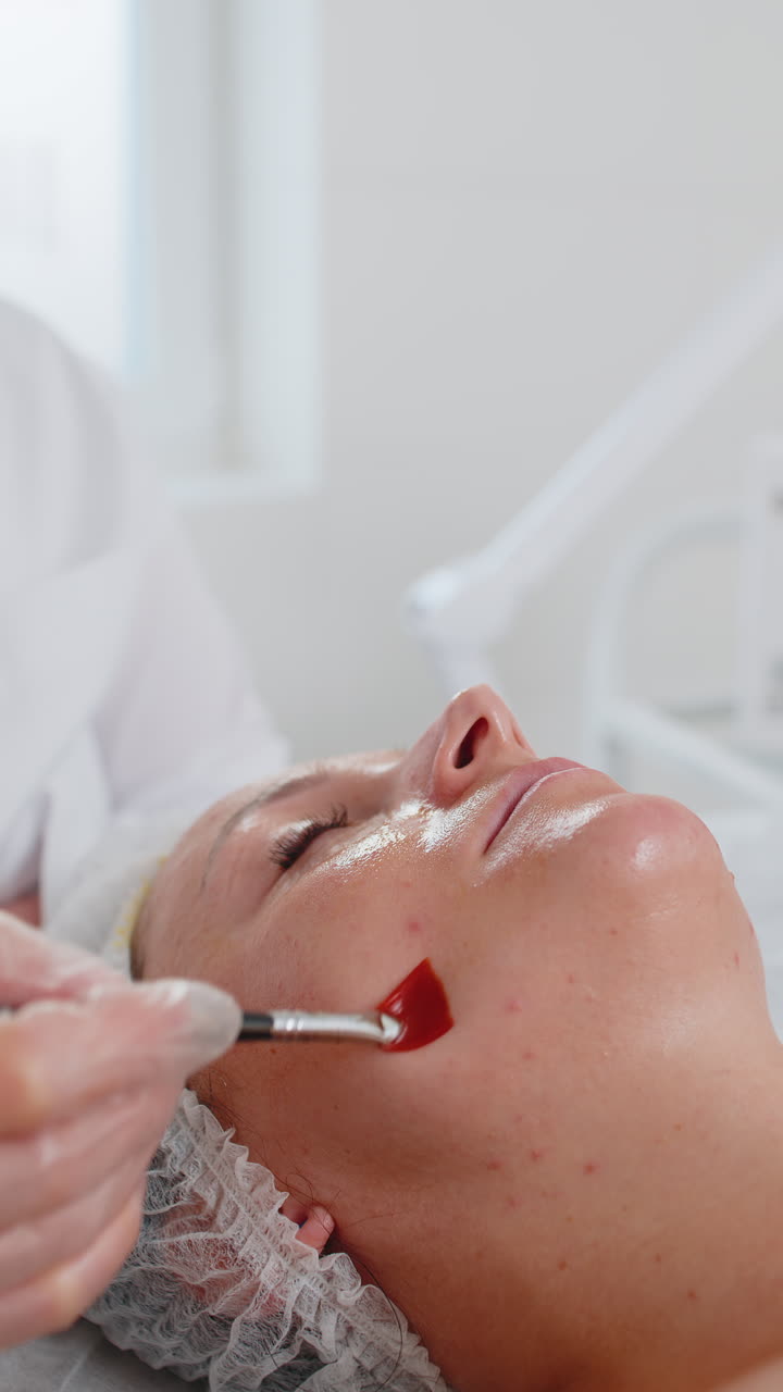 Kosmetolog påfører spesiell fuktighetsgivende syre-serum peeling på kinnet til en ung kvinne i klinikken