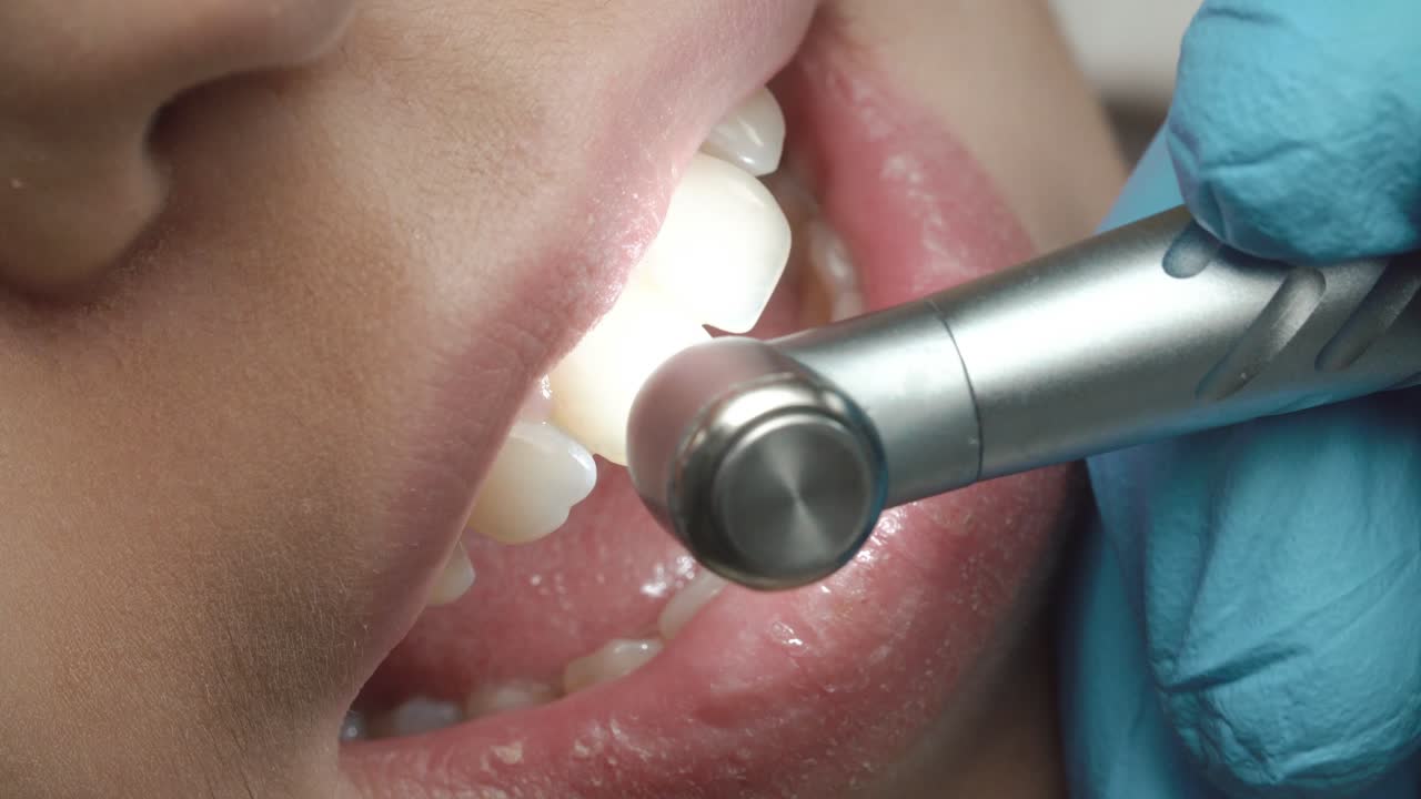 Dental Procedure Close Up