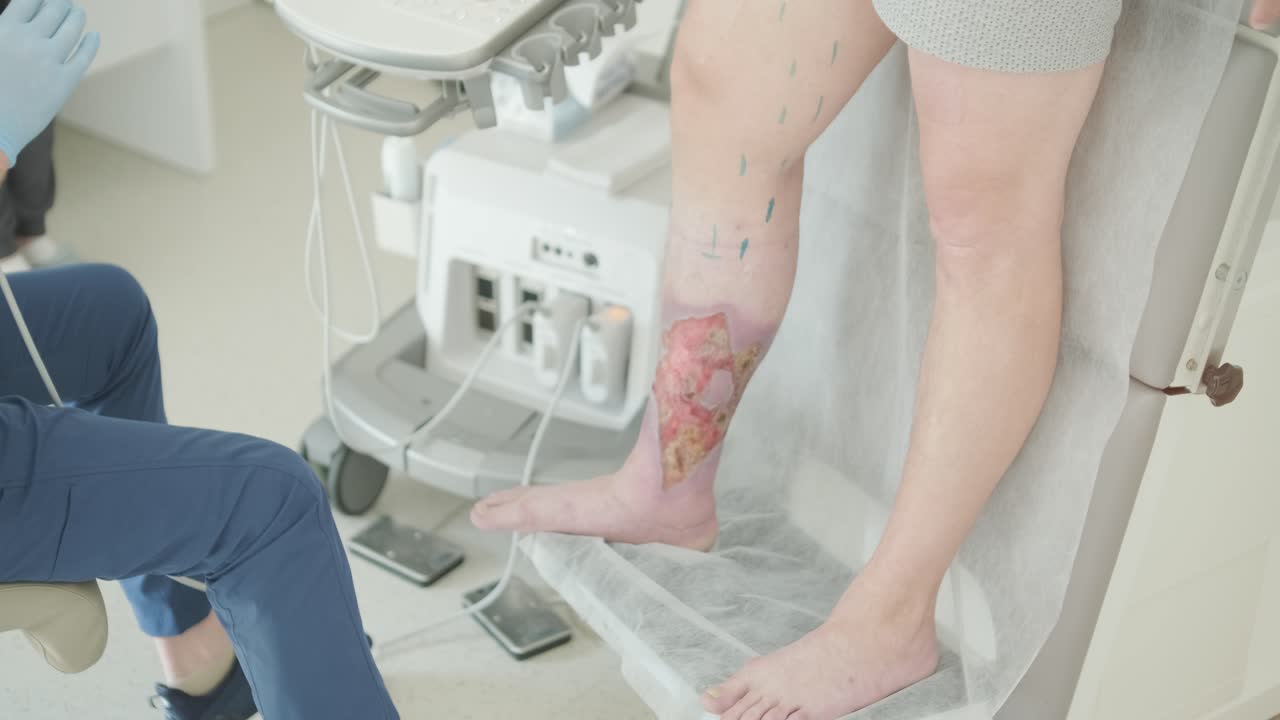 다리 양 환자의 의료 초음파 검사