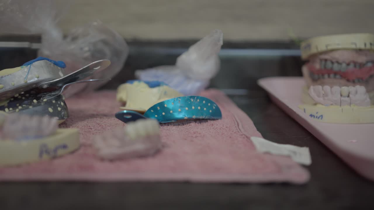 Various Dental Models and Tools in a Dental Laboratory
