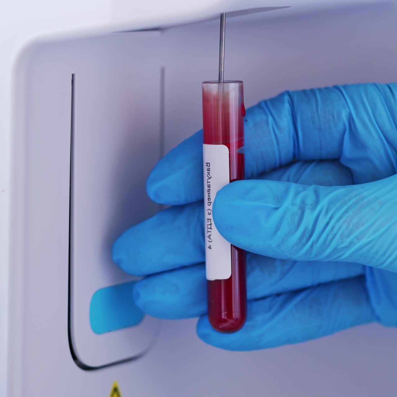 Technician with tube of blood sample