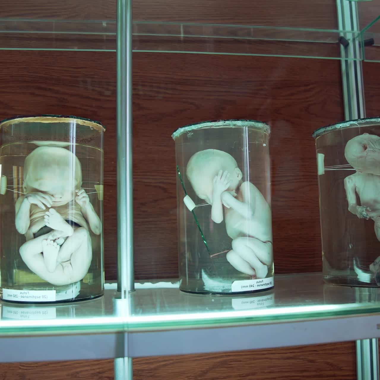 Fetus in formalin solution in museum. Human organs in jars with formalin in anatomical museum