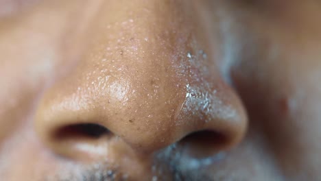 close-up of a person's nose with skin condition