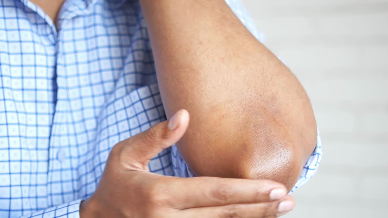 aplicación de loción en el codo seco