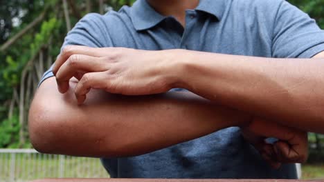 man scratching itchy arm