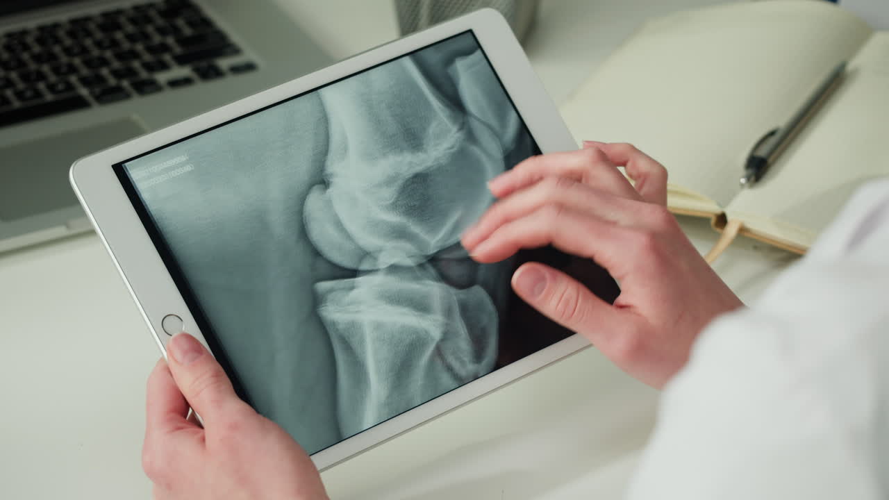 Doctor reviewing knee X-ray on tablet