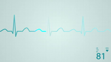 animation of a schematic diagram of normal sinus rhythm for a human heart seen on electrocardiograph screen. blue highlight on a bright background. perfect for any medical-related purposes.