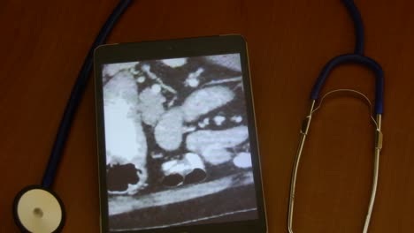 ct-scan auf einem tablet zur diagnose