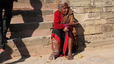 Alte-Dame-Mit-Elephantiasis-Bettelt-Auf-Dem-Gelände-Des-Taumadhi-Platzes-In-Bhaktapur,-Nepal