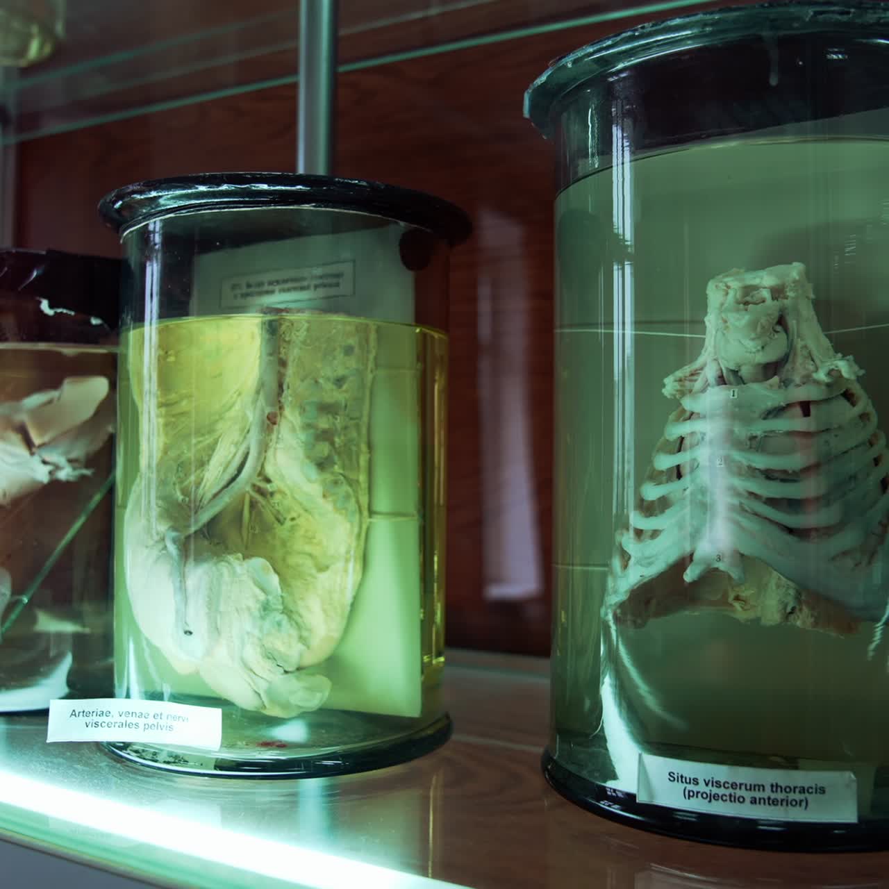 Internal organs of human in medical museum. Anatomical organs in glass tubes with formaldehyde