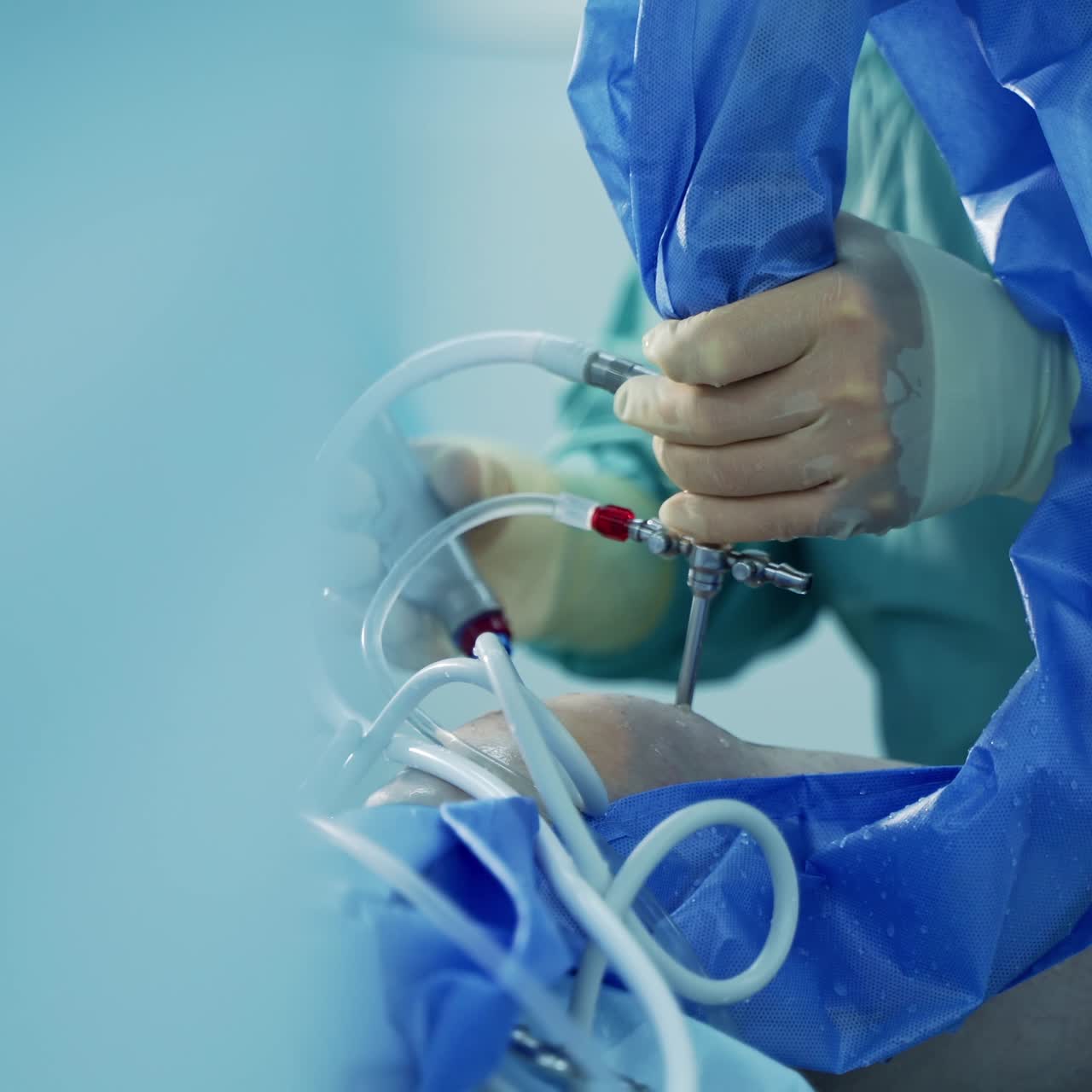 Modern surgery equipment working in operation. Team surgeon working in emergency ward