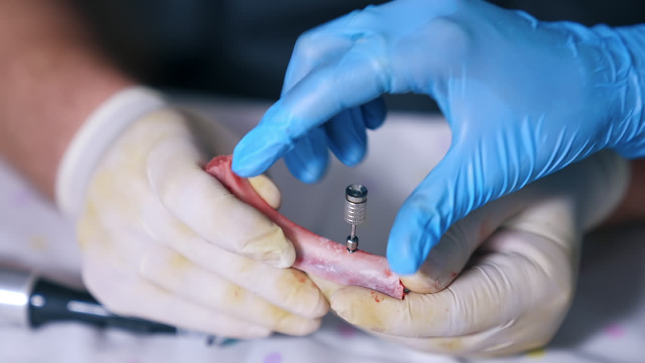 Hands in latex gloves hold a piece of bone. Hands in blue gloves attach rotating detail to a hole in bone. Close up.