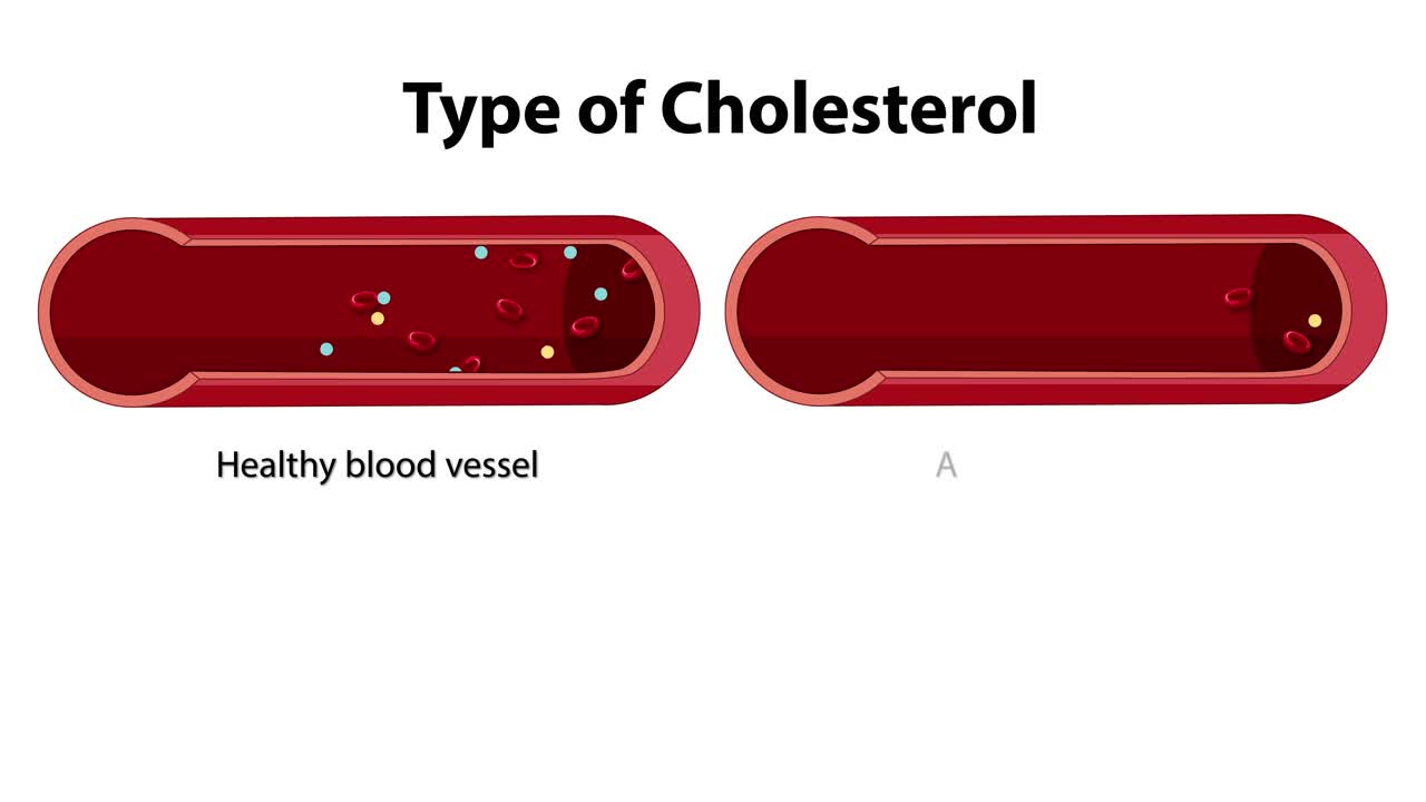 건강한 혈관과 동맥경화 혈관을 보여주는 애니메이션