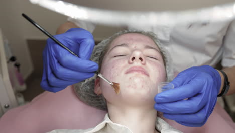 Acne Treatment Facial