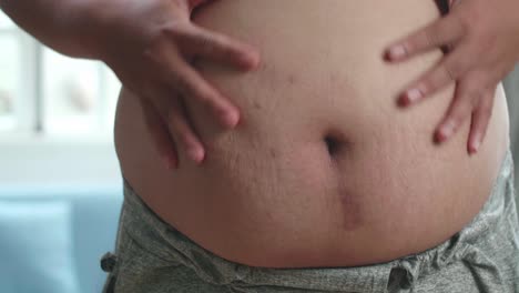 person with a large belly