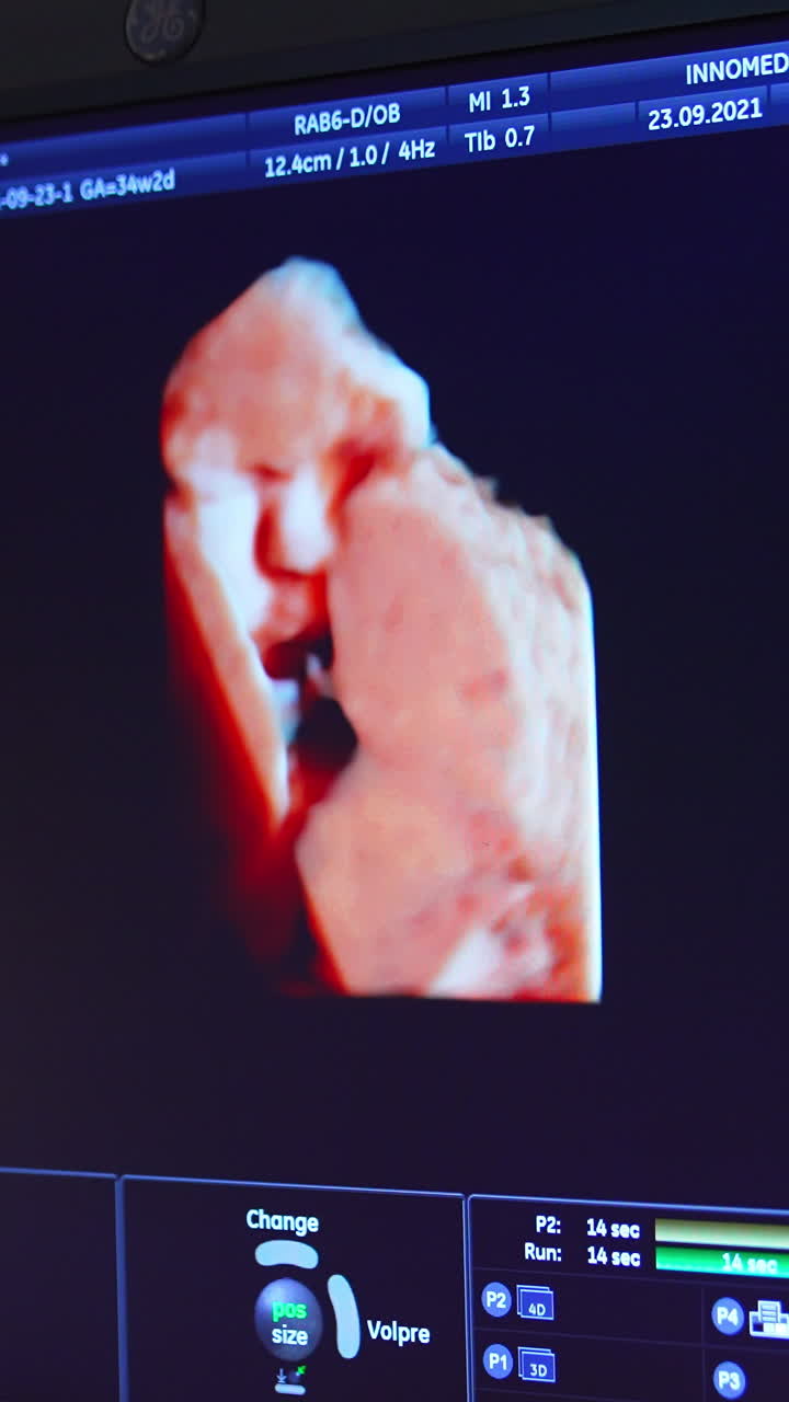 Baby moving in mom's belly shown at the screen. Life parameters on the blue monitor. Close up. Vertical video