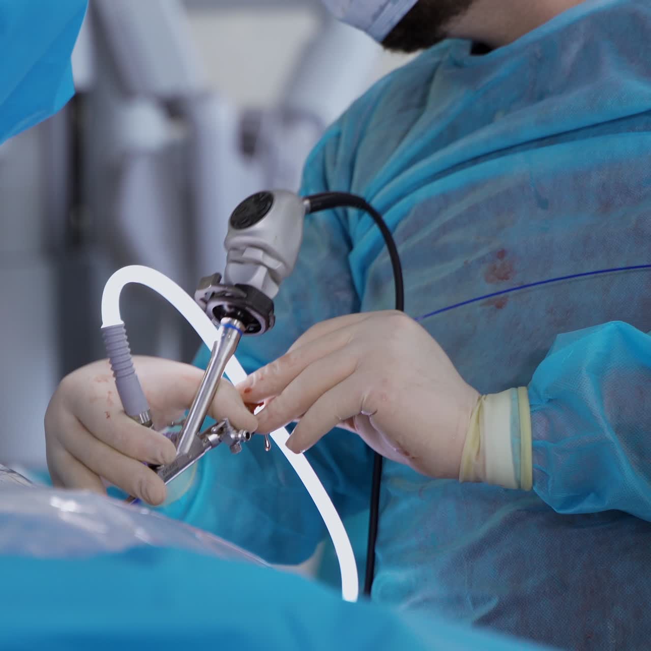Surgery operation on kidneys. Surgeon's hands in sterile gloves holding modern equipment during laparoscopic operation. Close-up.