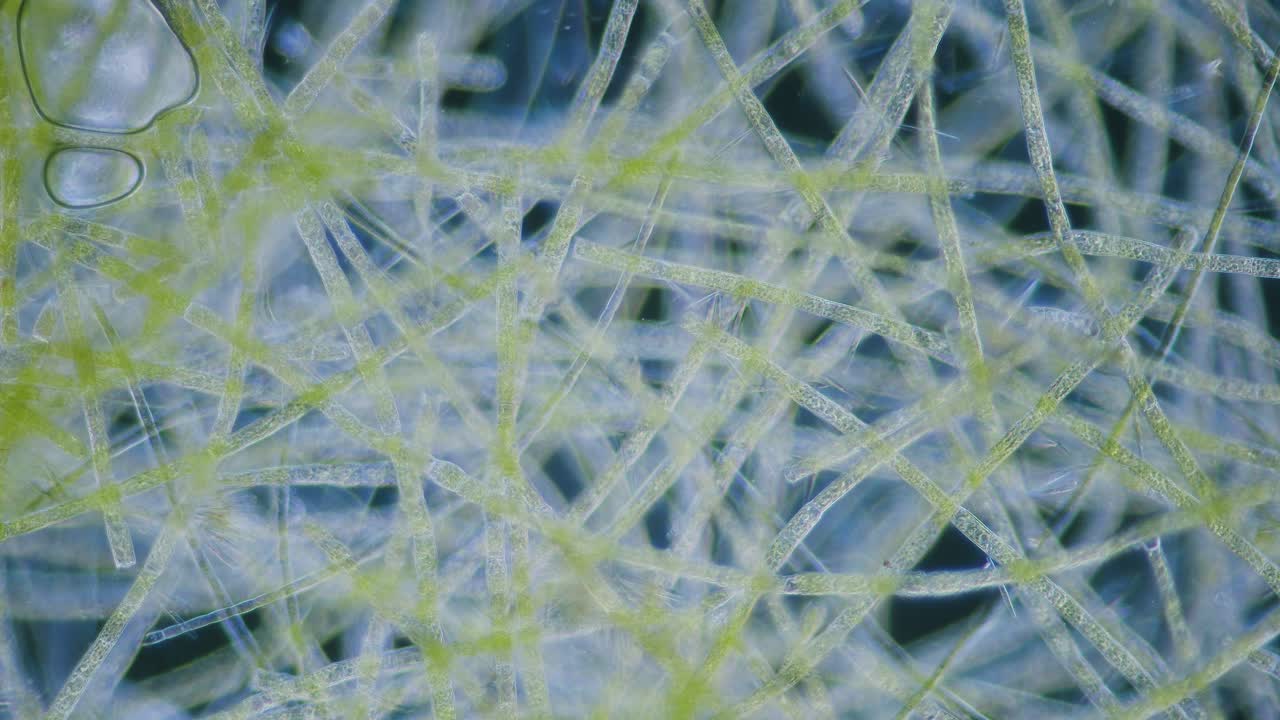 Filamentous green algae under microscope