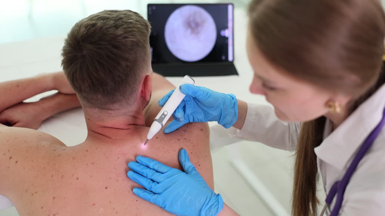 Dermatologo che esamina e tratta la pelle del paziente con un dispositivo medico