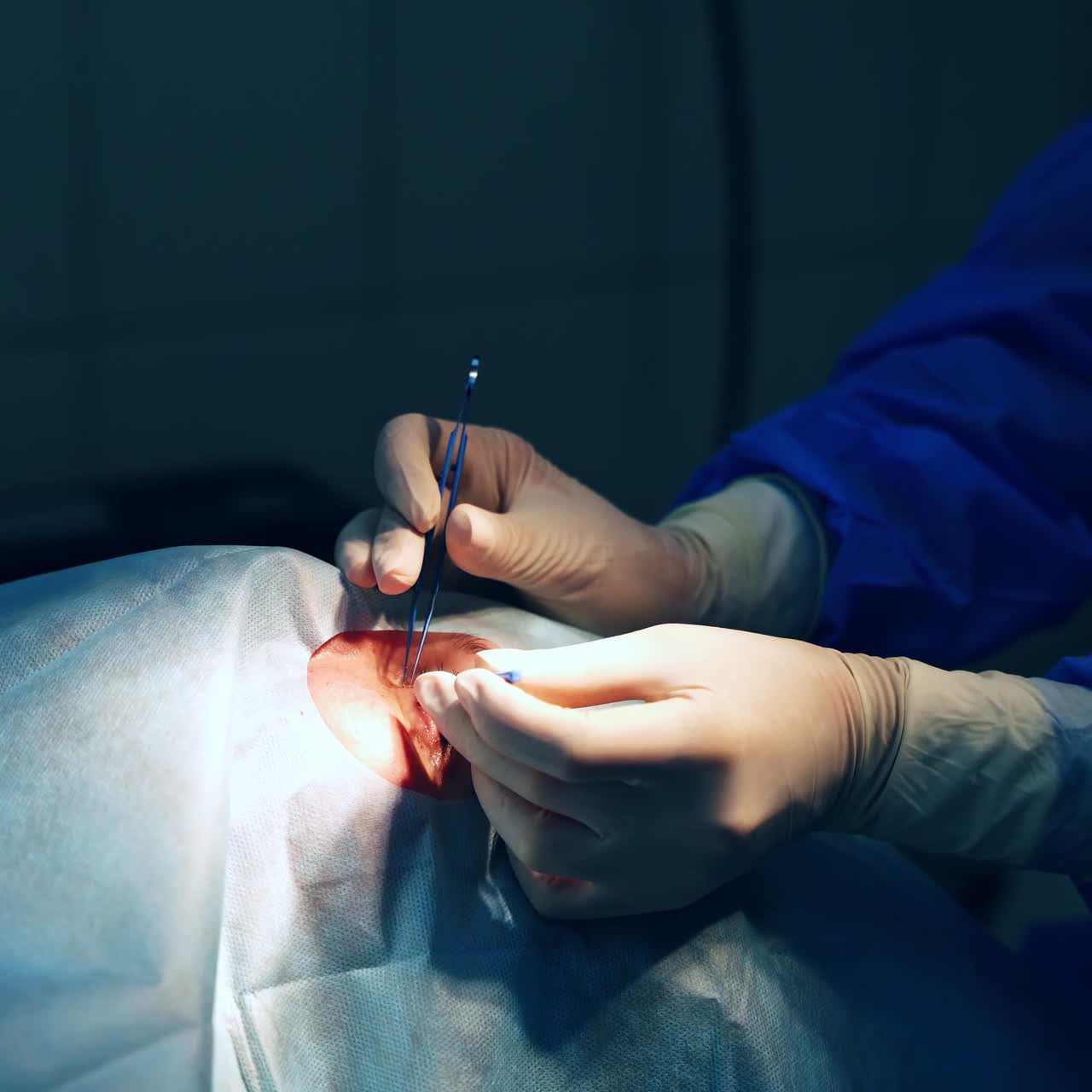 Patient under sterile cover