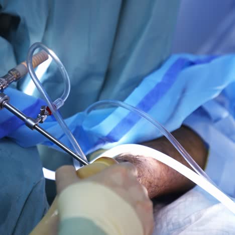 medical team performing operation. group of surgeon at work in operating theatre