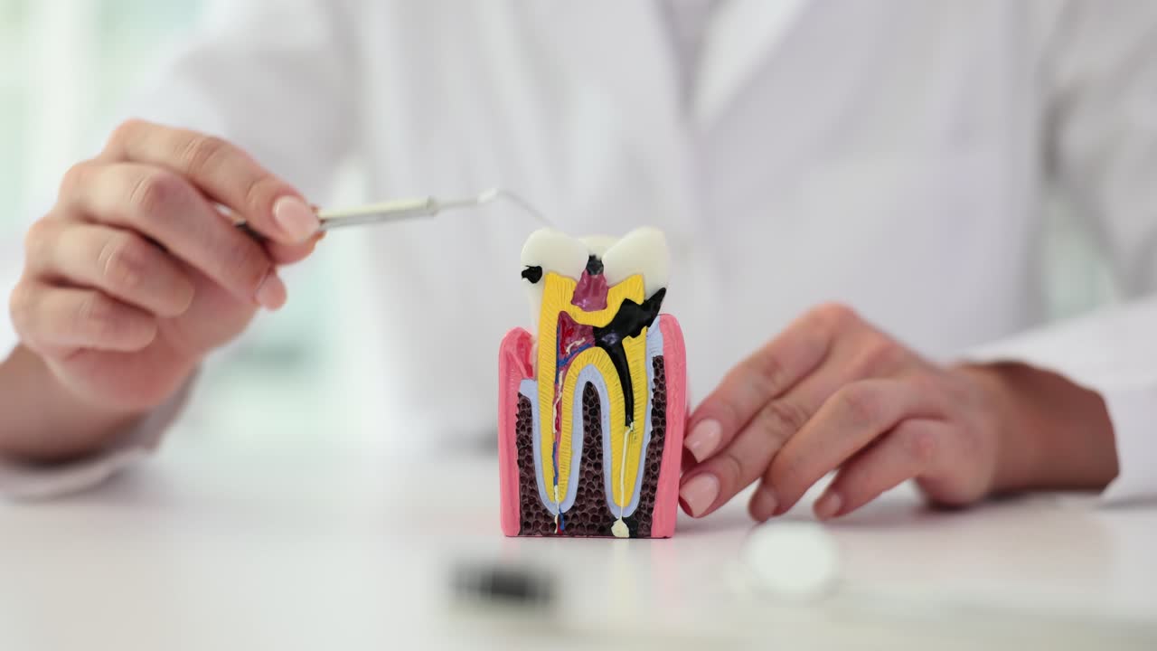 Dental Model Illustration