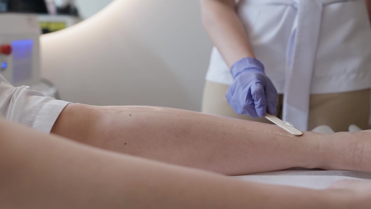 Terapista con guanti che spalma crema depilatoria sulla gamba di un cliente in una clinica di epilazione laser.