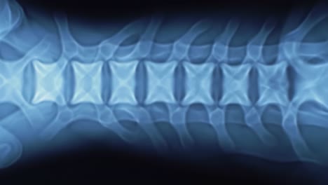 this presentation showcases an intricate view of the human spinal column, highlighting the vertebral alignment and overall structure. a deeper understanding of spinal anatomy is demonstrated.