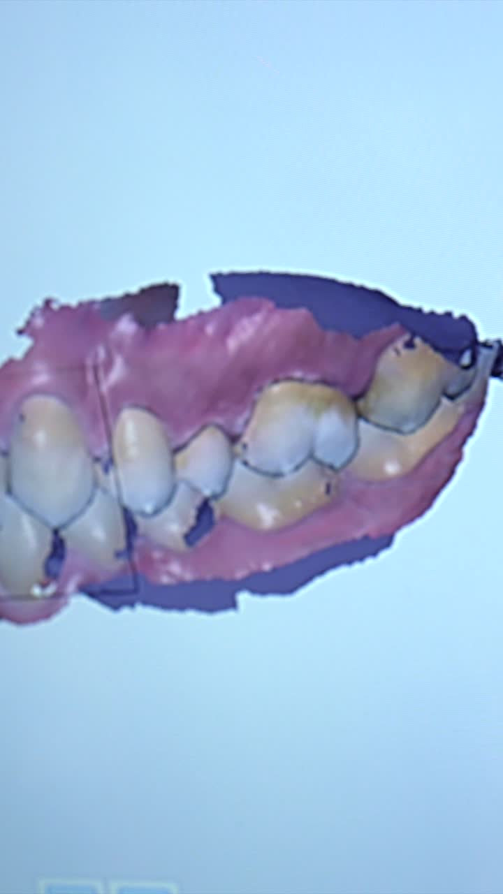 Dental scan of teeth