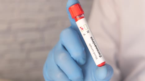 análisis de sangre para el coronavirus