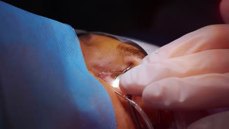 laser vision correction. a patient and team of surgeons in the operating room during ophthalmic surgery. eyelid speculum. lasik treatment. patient under sterile cover