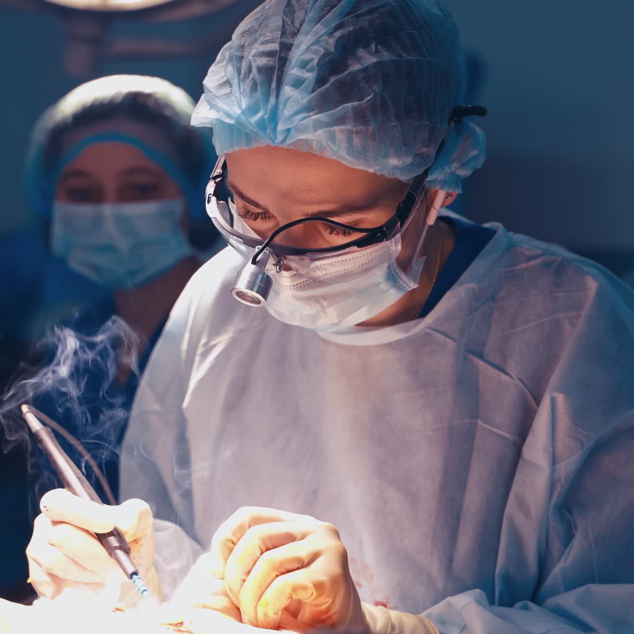 Plastikkirurgi, maveplastik, abdominoplastik.