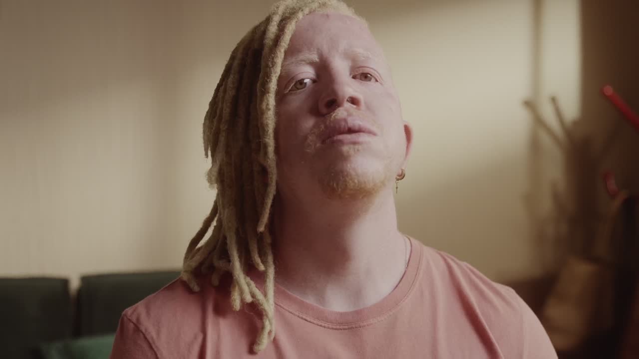 Portrait of an albino man with dreadlocks