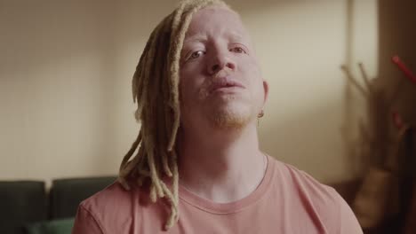 portrait of an albino man with dreadlocks
