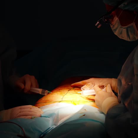 surgical procedure on dark background. medical specialists perform an operation on a patient in the hospital.