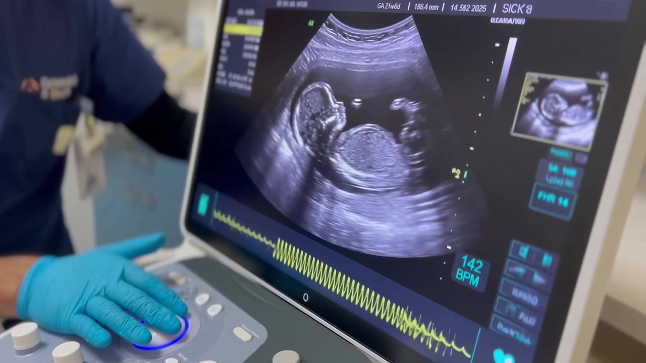 Medical Professional Performing Ultrasound Scan on Pregnant Patient