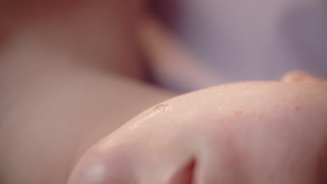 procedimiento de inyección cosmética