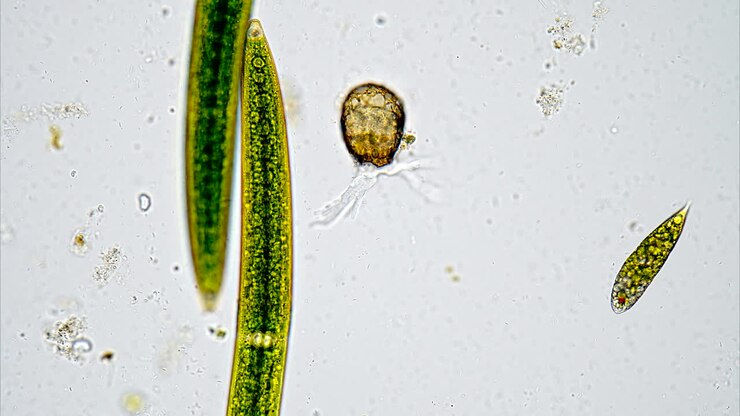 Microscopic view of green algae and protists in pond water