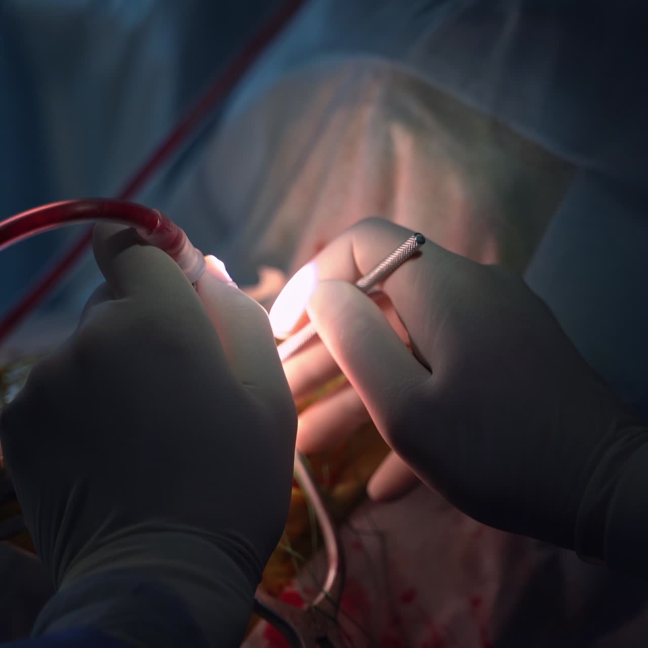 Close up view of neurosurgery work. Medical neurosurgeon specialists in uniform