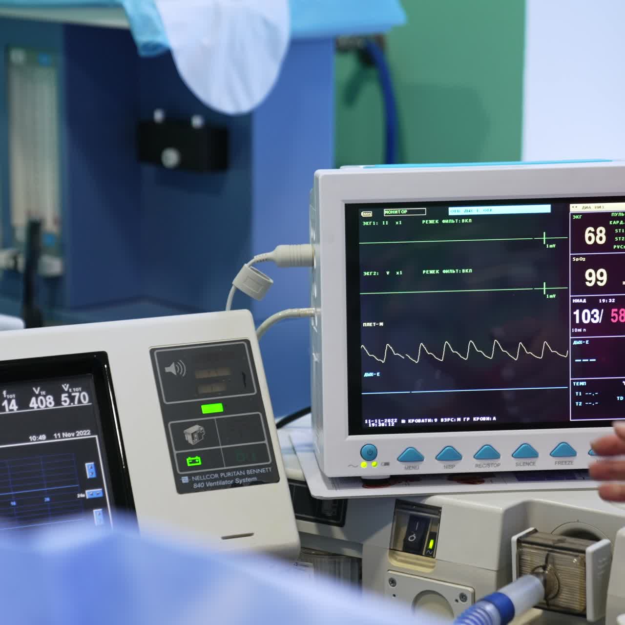 Equipment with screens switched on during operation. Modern medical apparatuses working in surgery room