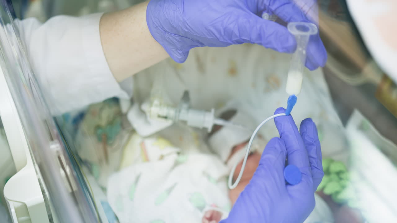 alimentación de un recién nacido en la unidad de cuidados intensivos neonatales