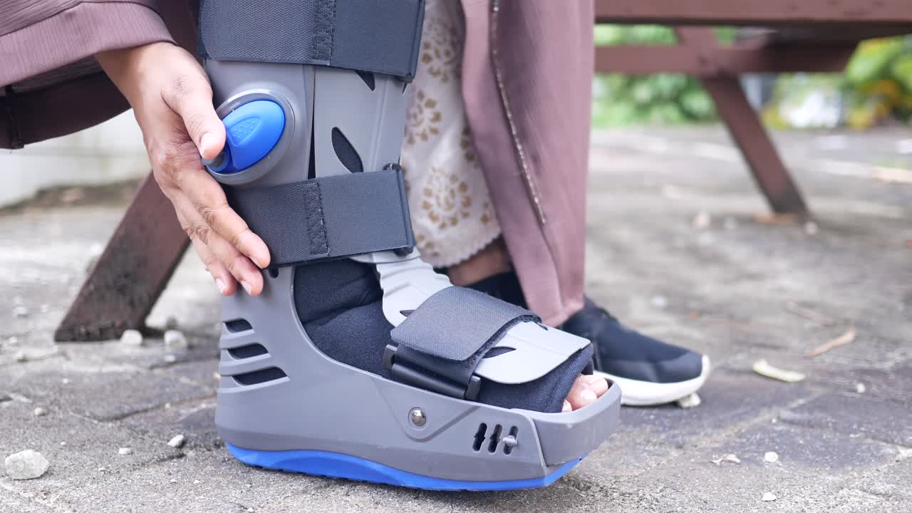 회색 플라스틱 부츠를 입은 여성의 발이 부러져 발목을 보호하는 부츠가 부상을 입었습니다.